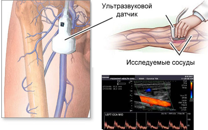 Уздг вен нижних конечностей